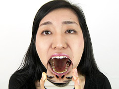 銀歯フェチ歯観察 由香里さんの口内