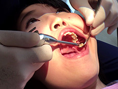 歯フェチ！本物歯治療映像虫歯掘削処置 堀越まき